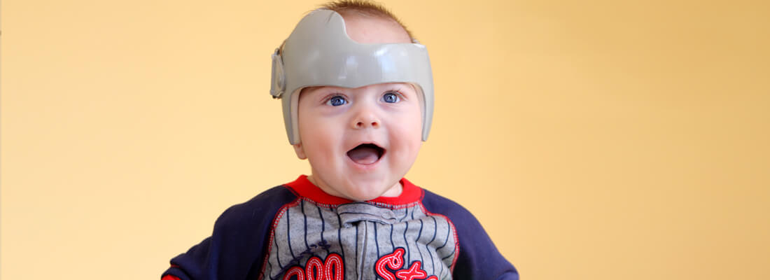 Est-ce une bonne idée de mettre un casque de protection à son bébé