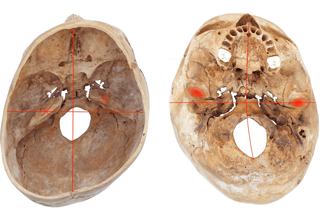 Schaedel eines Saeuglings Knorpelfugen und Schaedelnaehte
